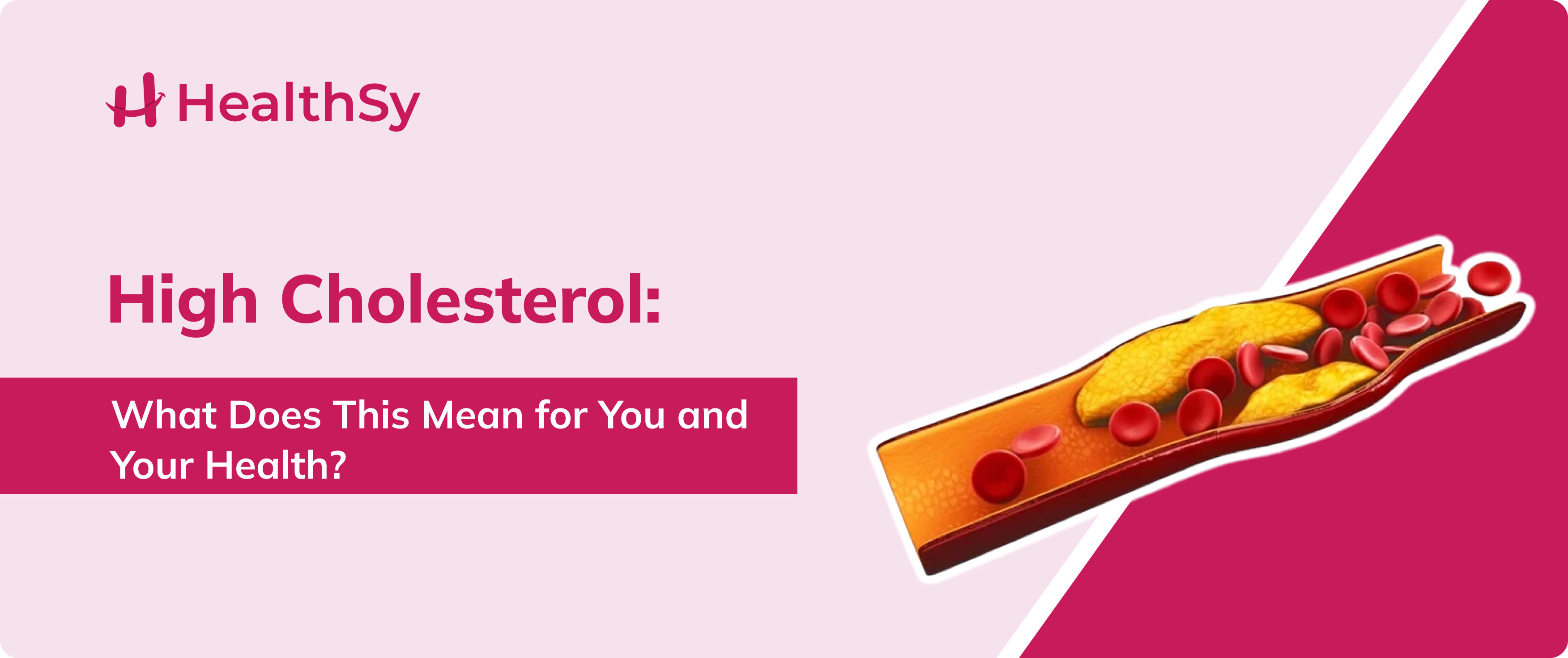 High Cholesterol: What Does This Mean for You and Your Health?